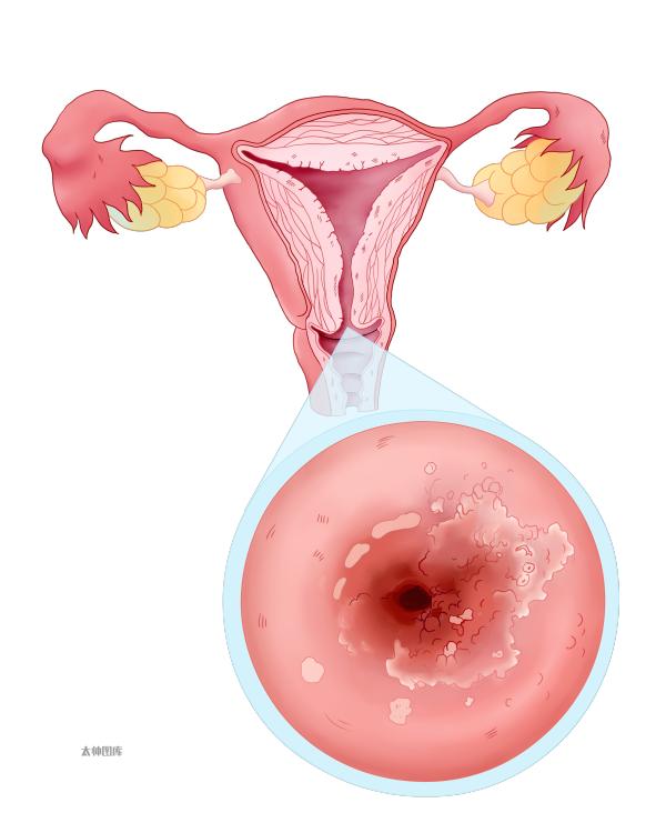 关于2023年度“两癌”筛查的公告