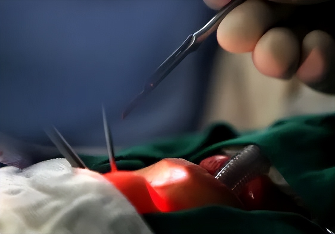 过敏季：雷暴哮喘刷屏，打鼻炎针管用吗