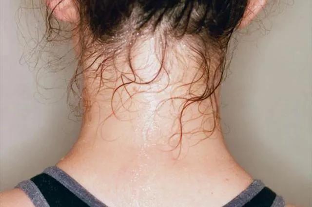 南京中医学院孟景春教授治疗盗汗