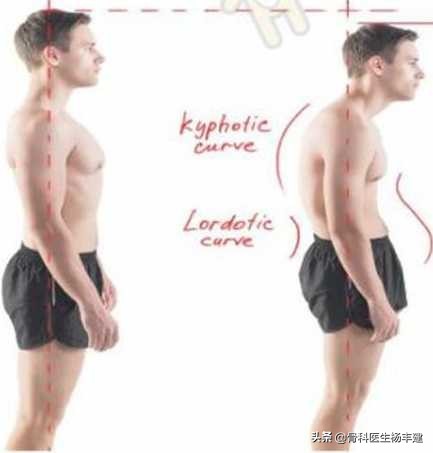 身高1.86米当骨科医生好不好,骨科长高建议