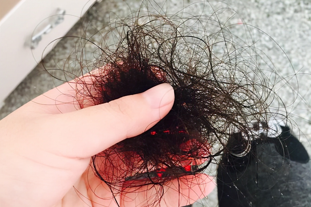 秋天掉头发的最佳防治方法,一到秋天就掉头发是怎么了