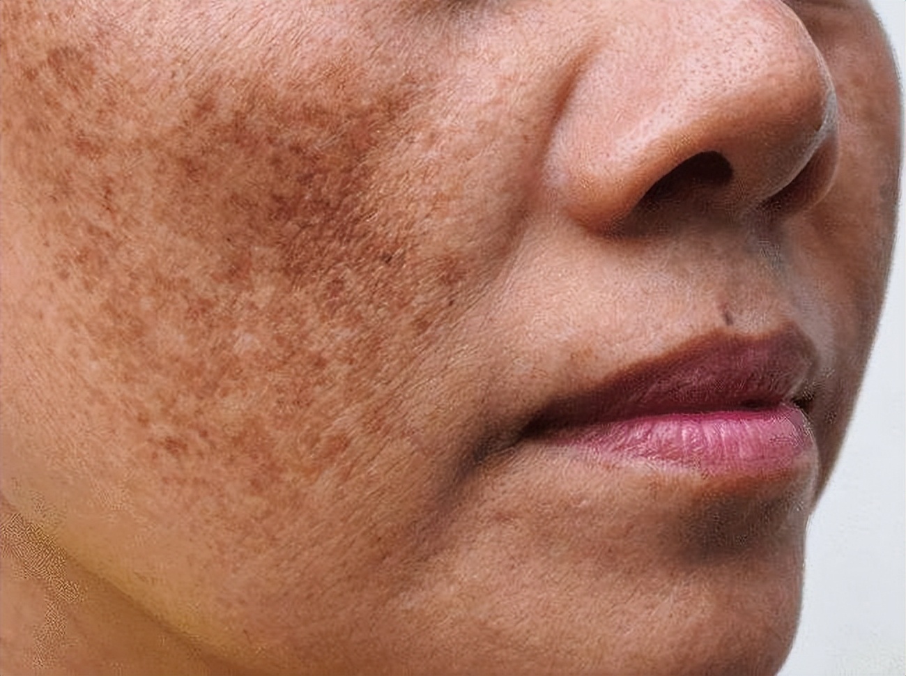 祛斑修复产品有用吗,祛斑淡化痘印产品