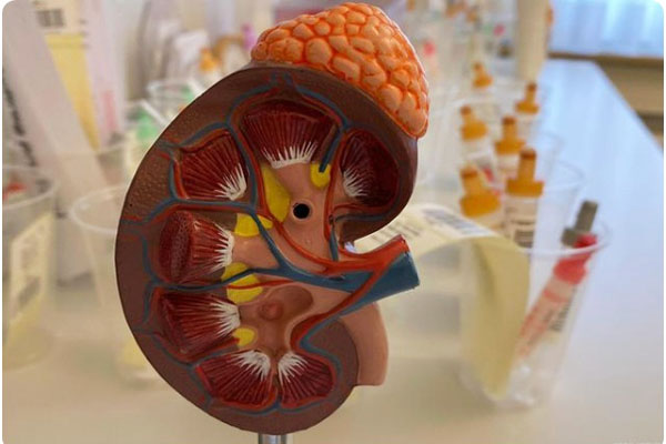 老人肾衰竭肌酐很高怎么办,慢性肾衰肌酐350中药调理有用吗