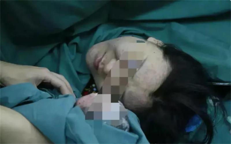 2015年43岁母亲将子宫移植给女儿,26岁女儿移植子宫生二胎