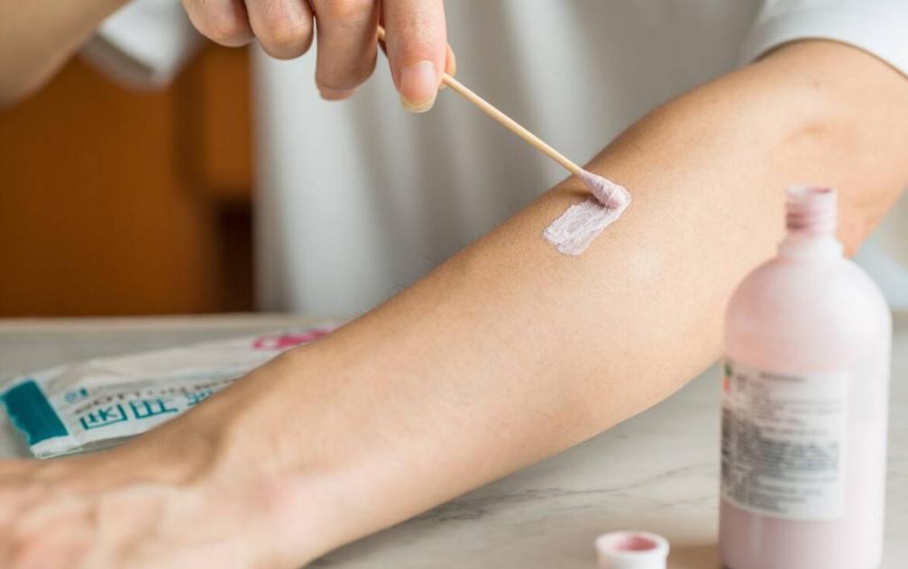 炉甘石洗剂，几块钱一瓶，却能治疗4种常见病，连世卫组织都推荐