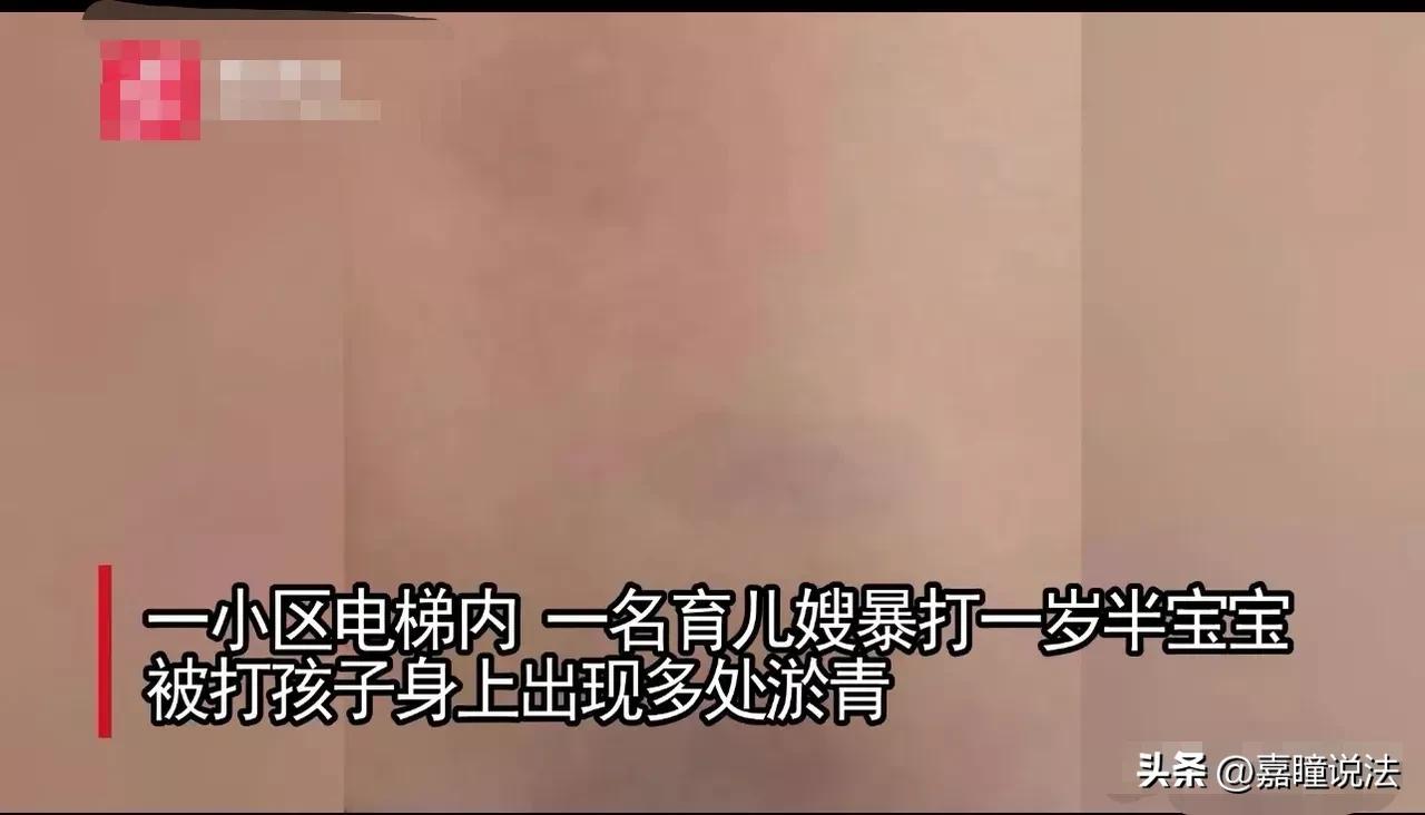 沈阳育婴嫂打孩子后续,沈阳育儿嫂电梯打小孩