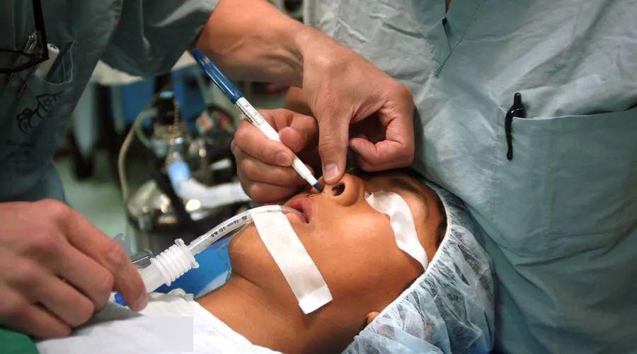 全身麻醉就相当于死过一次?全麻之后有什么感受？医生解答