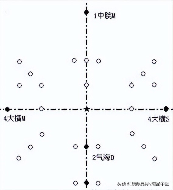 腹针疗法及16例常用处方