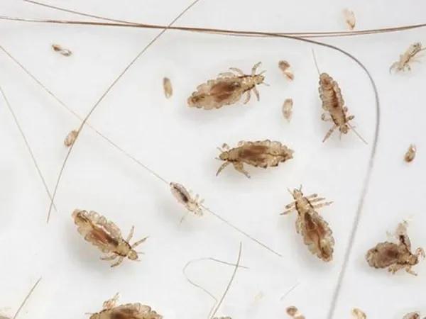 小时候头上长虱子的事,小时候头上的虱子是什么样子的