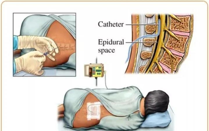 分娩体验馆男生出事故反转,分娩疼痛体验馆对身体有伤害吗
