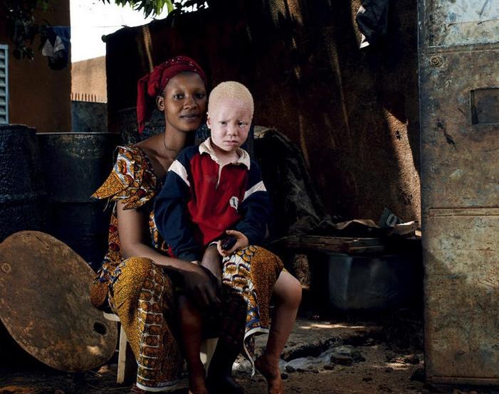 非洲版唐僧：血液堪比钻石，躯干价值126万元，警方24小时守卫