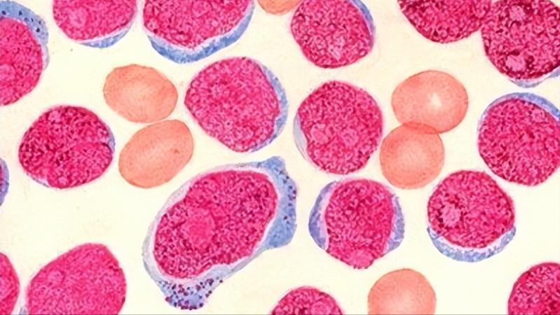 有一种痛叫带状疱疹,有一种剧痛叫带状疱疹