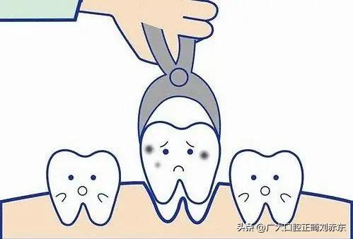 有蛀牙的能不能做牙齿矫正,有许多蛀牙可以牙齿矫正吗