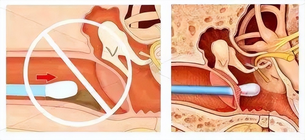 肚脐眼的黑泥到底可不可以抠,人体的秘密全部视频
