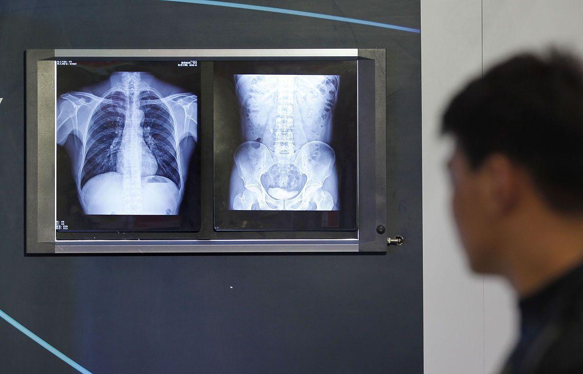 肩膀特别痛引起肝癌的几率大不大,肩膀痛查出是肝癌是中期还是晚期