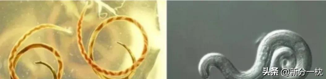 福寿螺的寄生虫有多可怕,寄生虫福寿螺