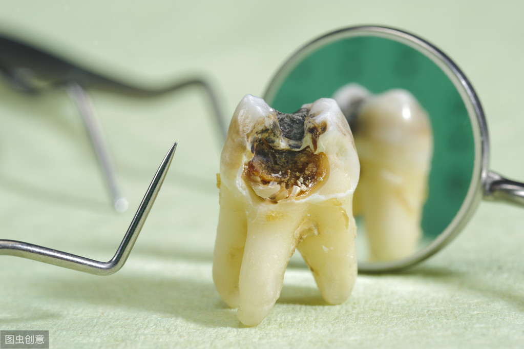 过年牙疼怎么办医生都不上班,老牙疼怎么办最有效方法