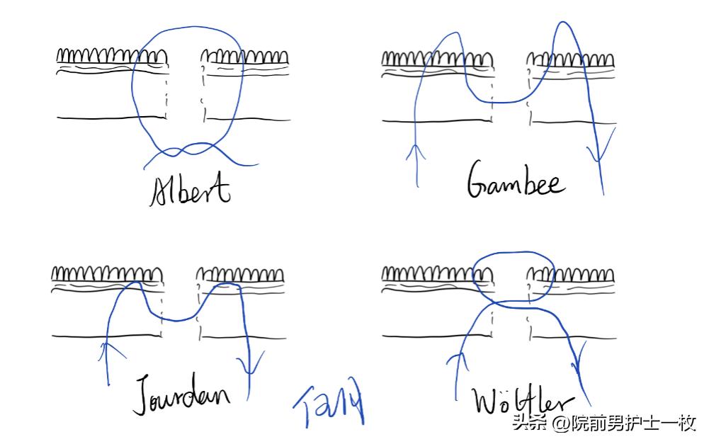 关于急诊清创缝合术必须掌握知识