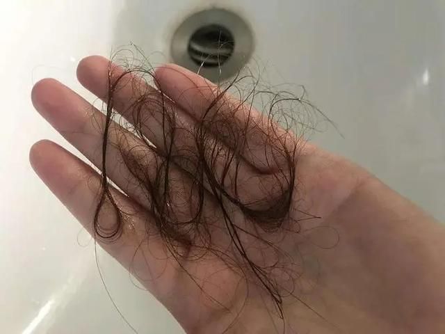 女性经常“掉发”，是怎么回事？或与这5种因素有关，别胡思乱想