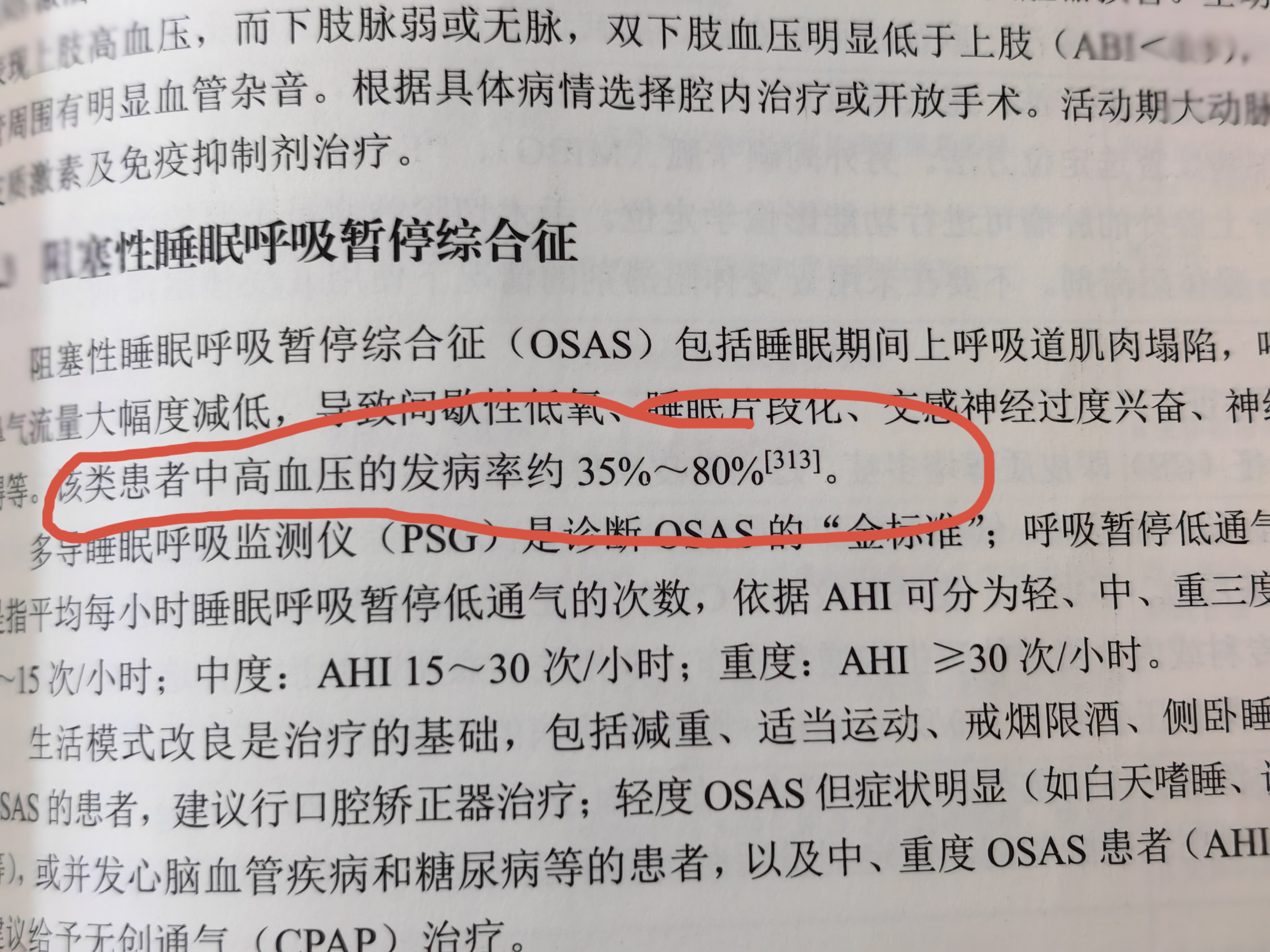 睡觉有七种现象,睡觉有这5个习惯