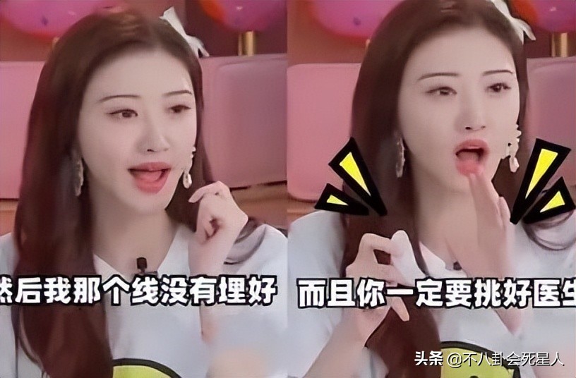 景甜双眼皮调整前后,明星自曝医美