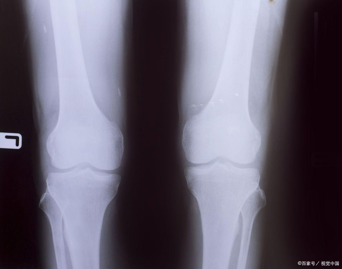 女孩子来大姨妈怎么快速长高,如何在大姨妈期间快速长高10厘米