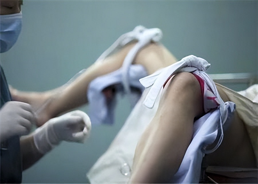 做完人流的女人有什么症状,女生做了人流之后身体情况