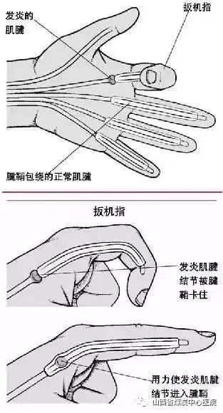 山西煤炭中心医院超声科主任,山西省煤炭中心医院在哪