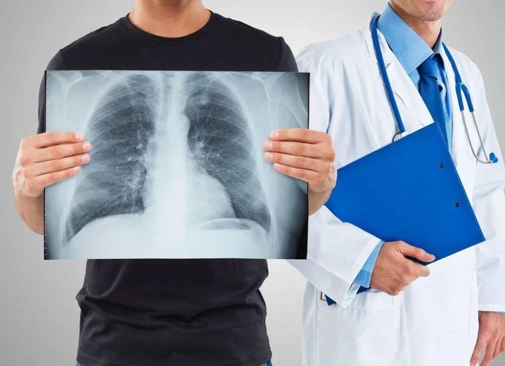 肺结节患者为什么不能吃牛肉,有肺结节的不能吃牛肉吗