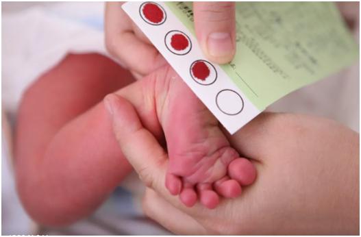 小胖威利综合征可以用基因修复吗,小胖威利是甲基化异常吗