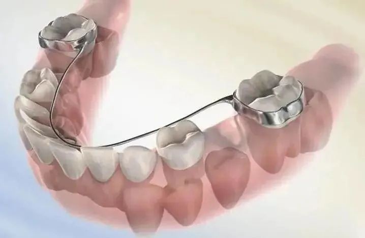 孩子换了牙歪了拔了还会长吗,小孩换完牙牙齿长歪能戴牙套吗