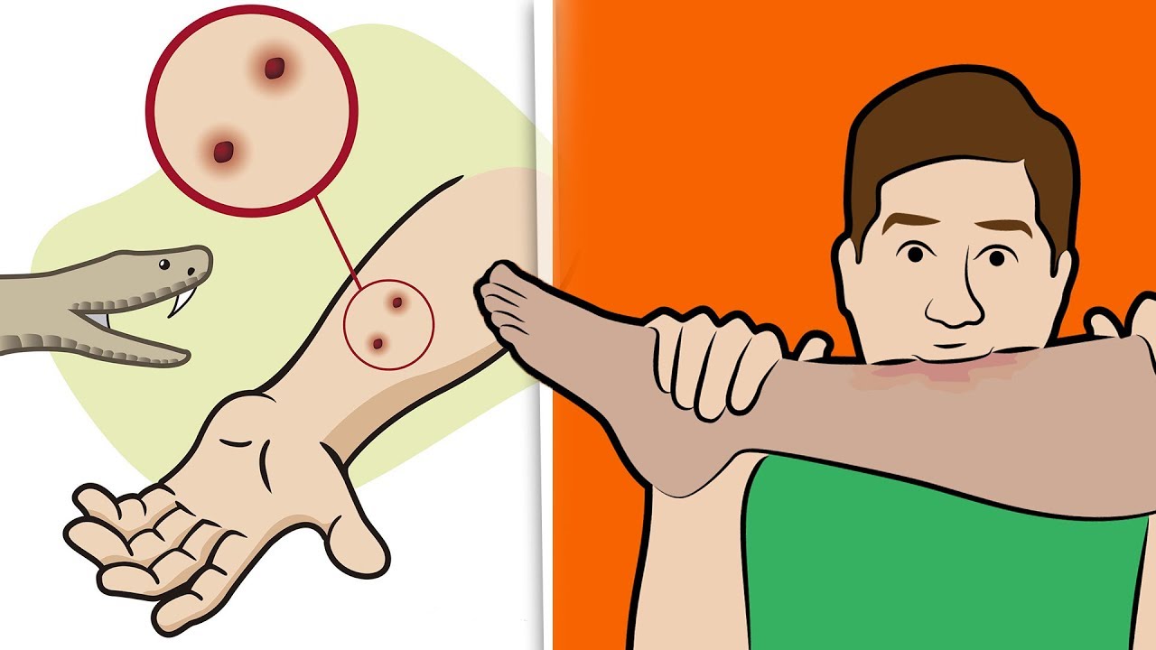 眼镜蛇被炖汤后，被剪掉的蛇头突然“复活”咬人，老伯差点丧命