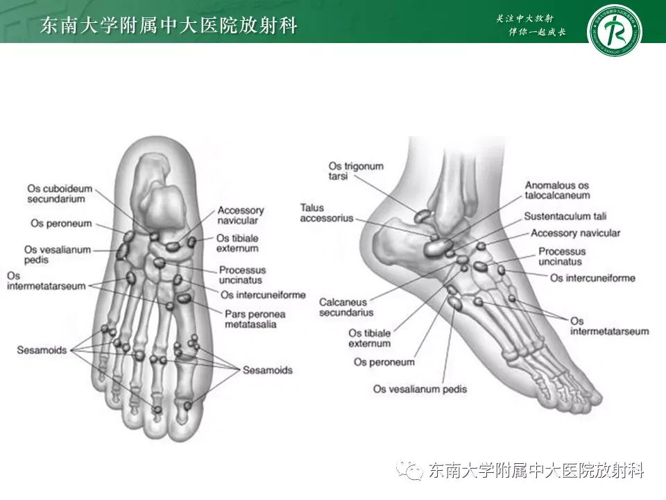 好文分享-《肌骨系统疾病——副舟骨综合征》