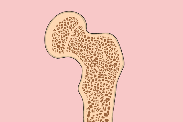 伤筋动骨100天一味静养也不行,伤筋动骨一百天注意什么