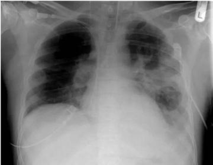 2023年12月11日2点11分,2023年12月11日11点43分