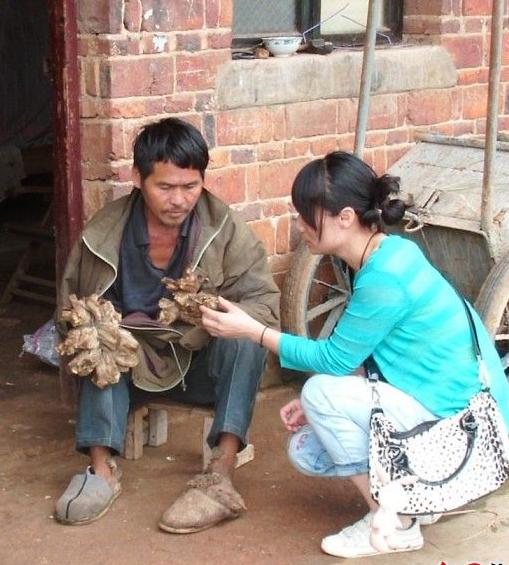 男子手长满树疙瘩是什么病,男子手长满树疙瘩手术了吗