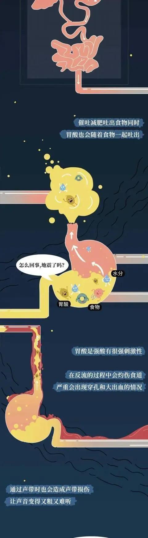 被“仙女管”插进体内的女人，最后会发生什么？可能让人接受不了