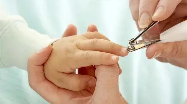 孩子的指甲壳上有白点,小孩指甲里有白点是缺乏维生素吗