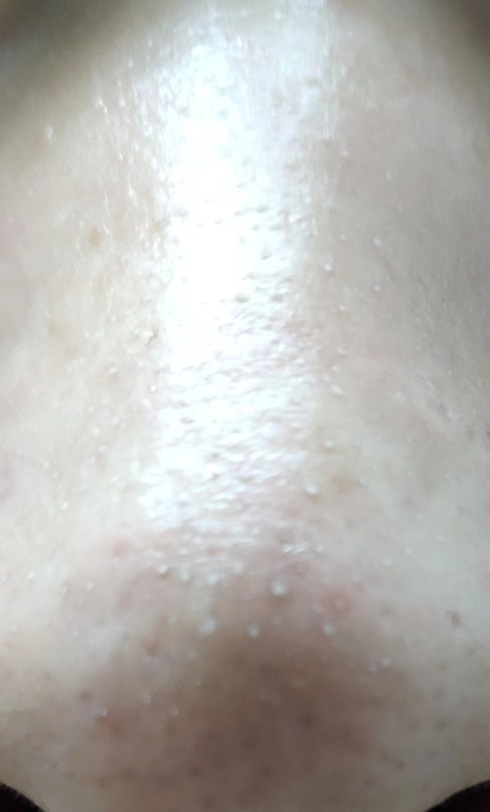 卸粉底后感觉鼻子上的毛孔有白点,为什么上完粉底液鼻子上有黑点