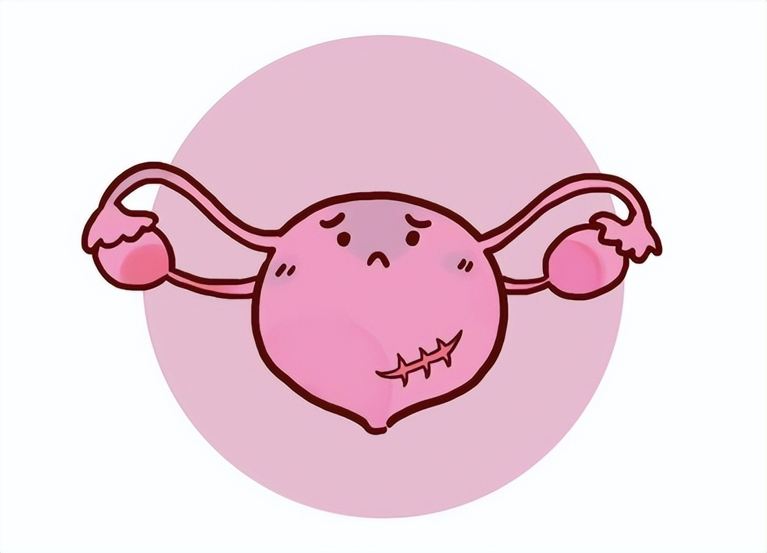 子宫性不孕症诊断与治疗,子宫发育不良性不孕确诊检查