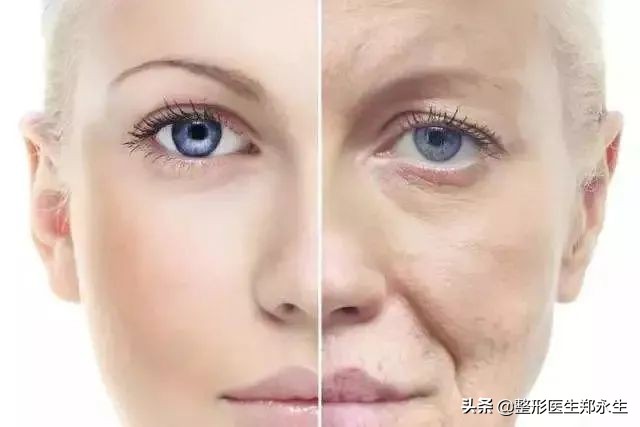 轻松去除面部皱纹的最有效方法,男士面部皱纹去除妙招