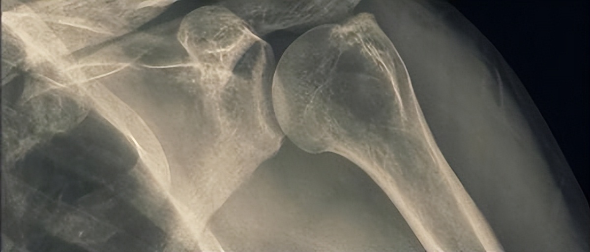 新加坡女孩离奇坠亡父亲家暴,新加坡坠亡女孩遭遇父亲家暴