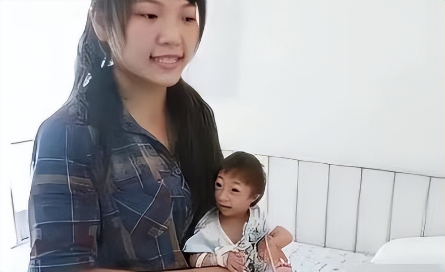 湖南生下小猴子卖给马戏团,湖南一产妇生下“小猴子”