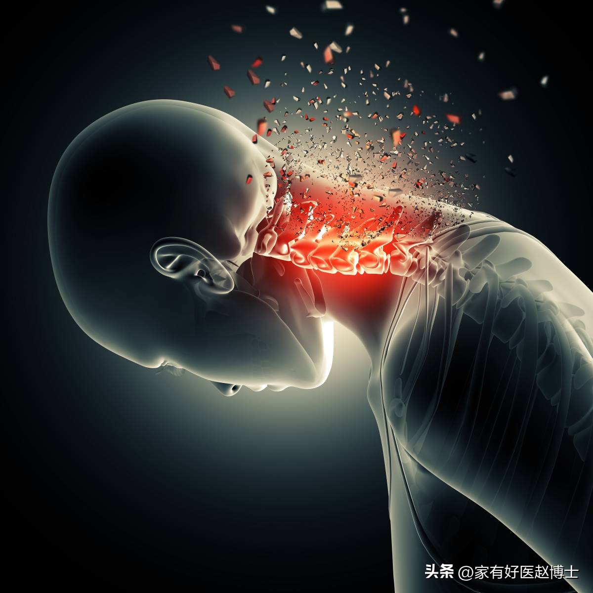 高血压患者出现头晕症状要怎么办,高血压一级头痛头晕需要吃药吗