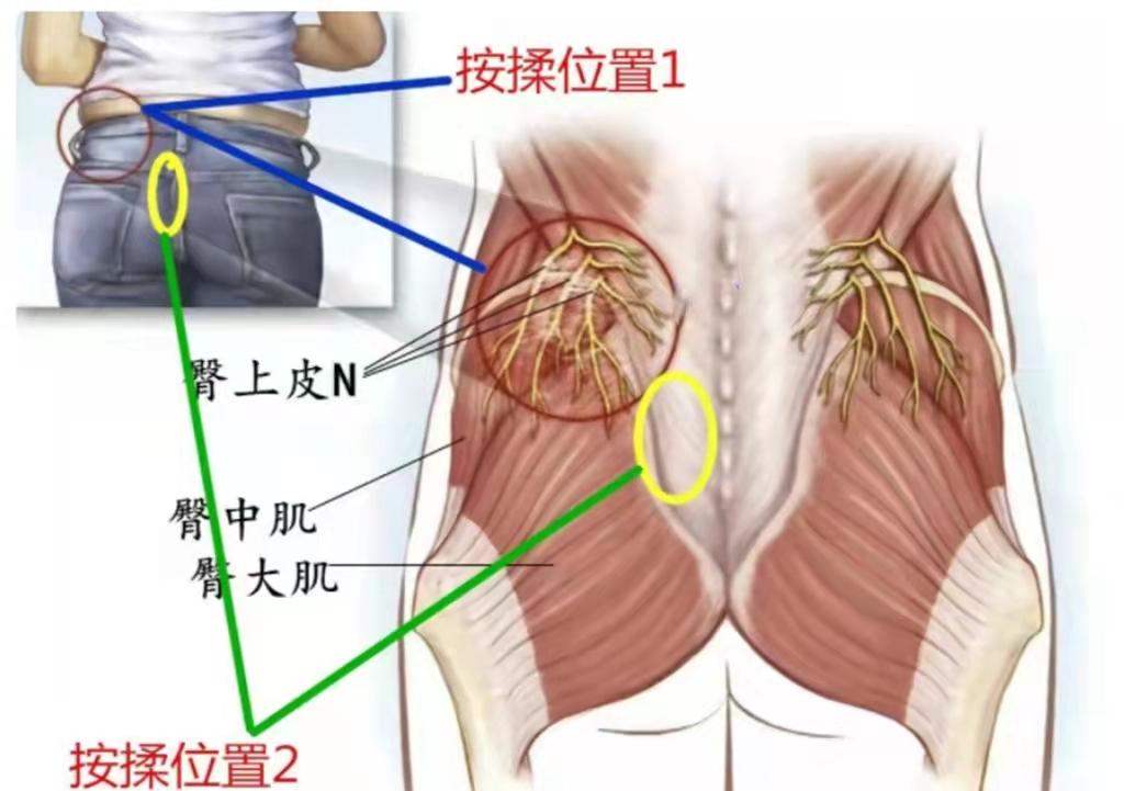 彻底治好腰椎间盘突出的方法,各种腰椎间盘突出治疗方法的弊端
