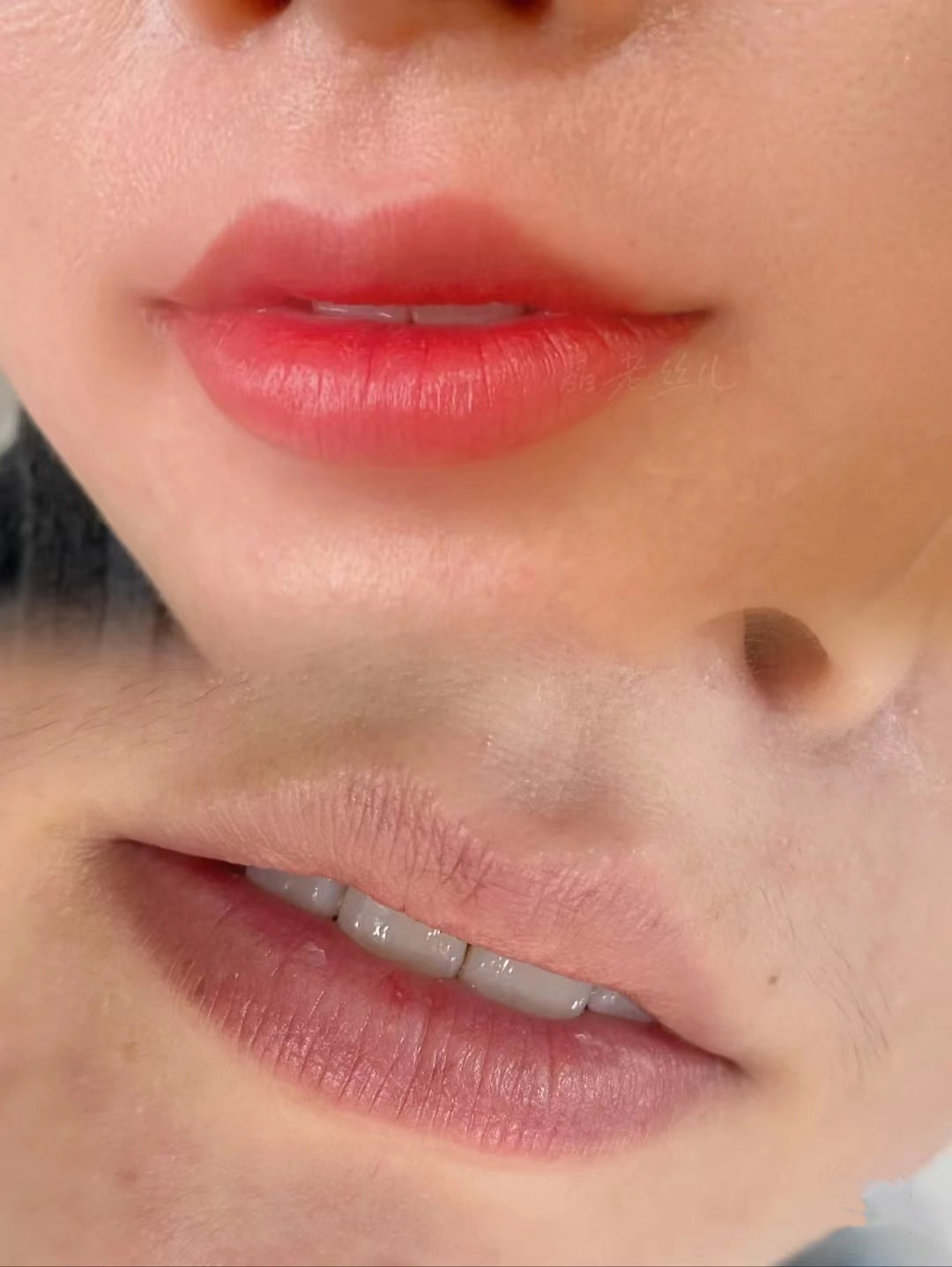 纹唇的正确方法和注意事项,纹唇时候要动嘴吗