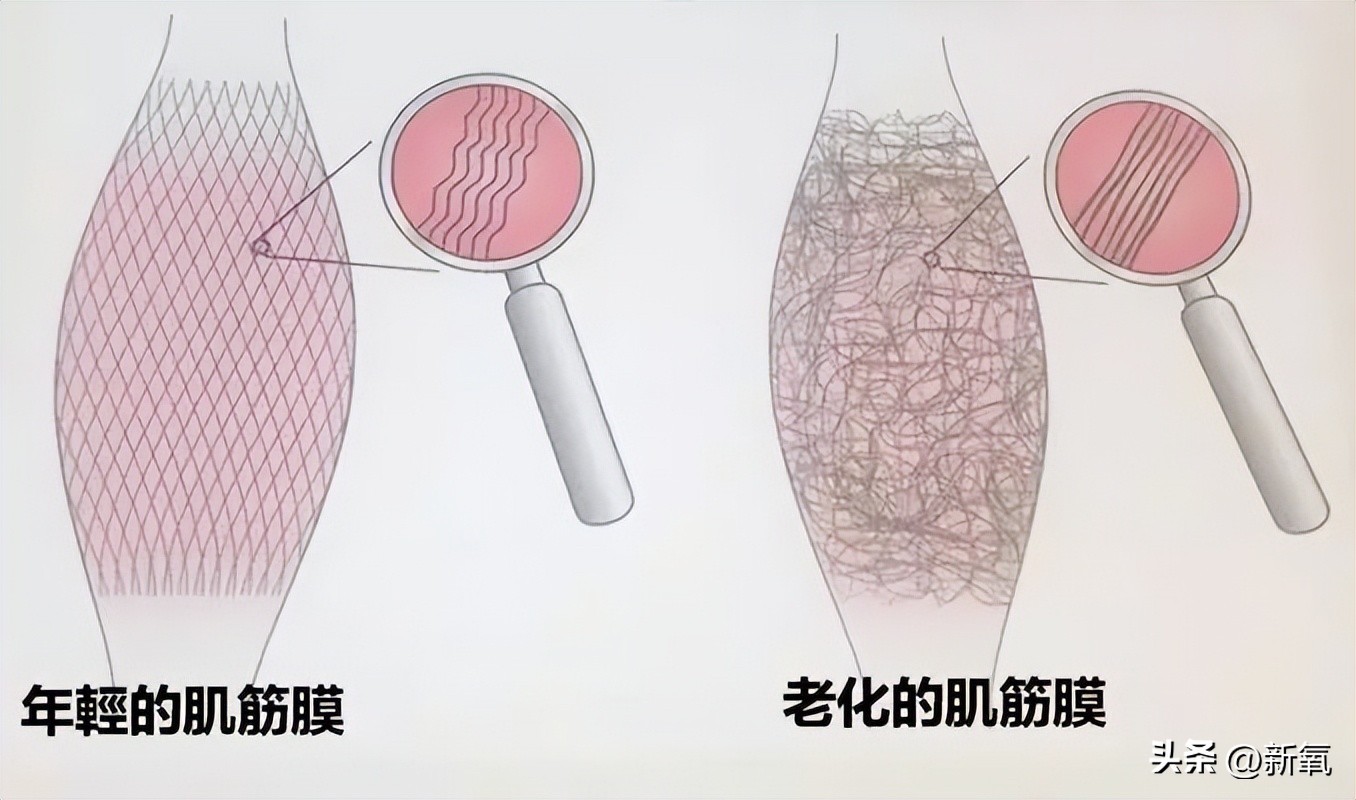 脸太下垂,脸下垂了是不是就显胖