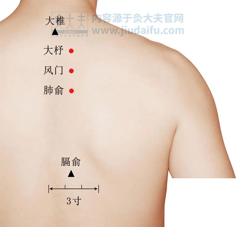 湿疹分为干性湿疹和湿性湿疹吗,湿疹反复发作不好是什么原因