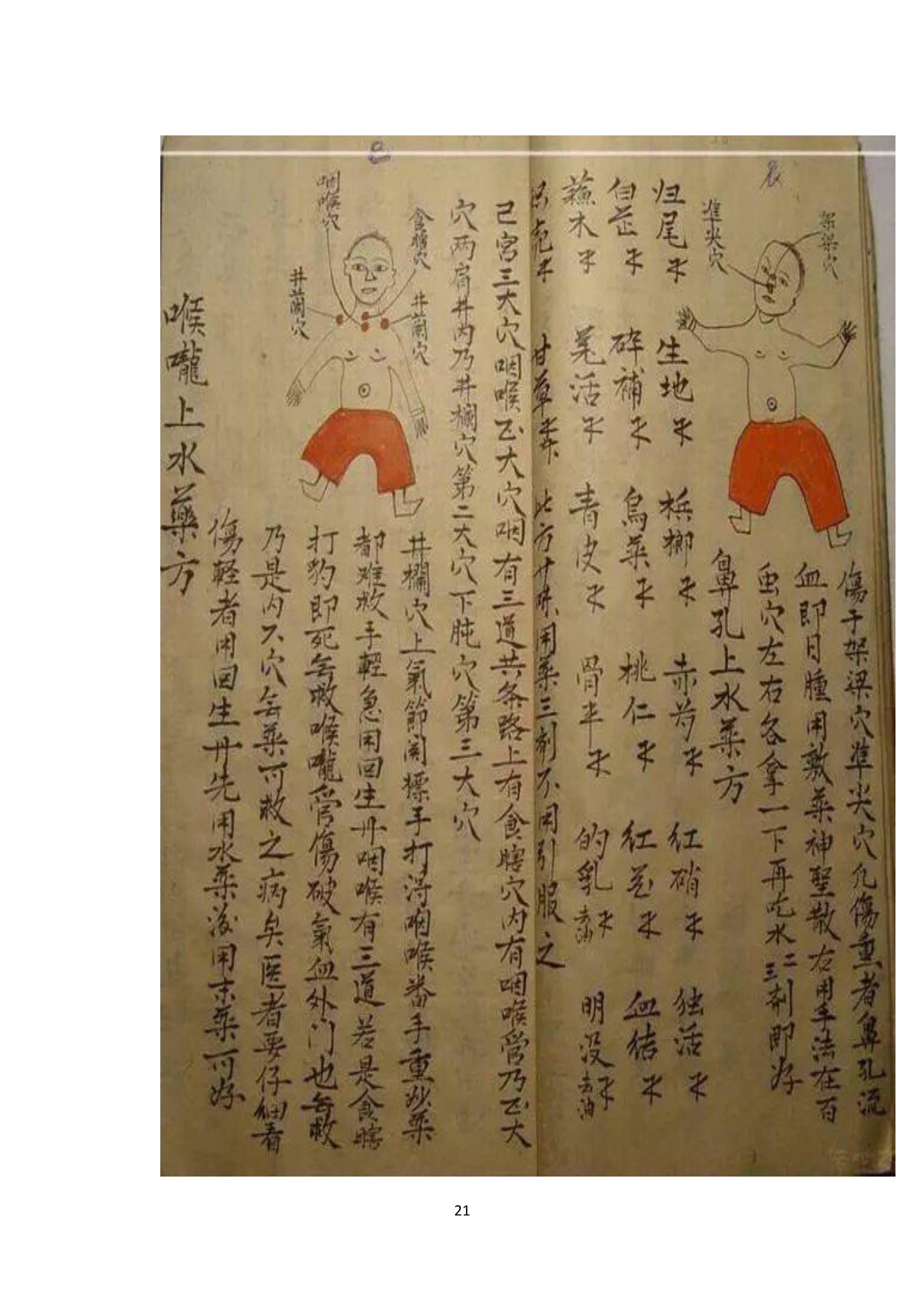 中医古书籍清代带图且内容非常好的手抄跌打损伤良方