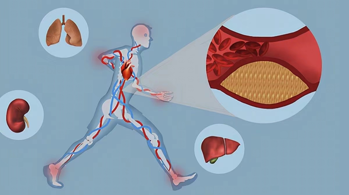 清理血管垃圾打吊瓶,年纪大了打扩血管针好吗